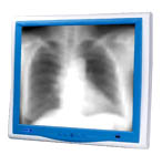 研揚(yáng) ONYX-195醫(yī)療級平板電腦