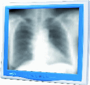 7/200807071134249575