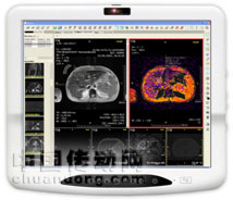 19吋醫(yī)療照護(hù)工作平臺M1920